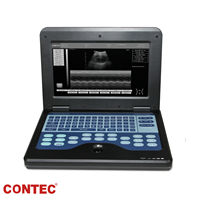 Échographe Portable CONTEC CMS600P2 Système de Diagnostic Ultrasonique avec Sonde Linéaire