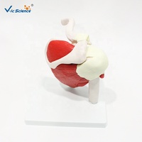 Modelo de Articulación de Hombro de Tamaño Real con Músculos, Modelo Anatómico de Ligamentos Musculares del Hombro Humano, Enseñanza de Ortopedia, CE/ISO/ROHS/CNAS