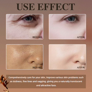 Oem Private Label Hydraterende Verhelderende Gezichtsset Anti Veroudering Rimpel Acne Gezicht Whitening Collageen 24K Goud Huidverzorgingsset - Product Image 5