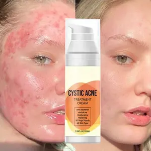 Private Label CYSTIC ACNE Cream For Face Organic Salicylic Acid Anti-Acne Treatment Repair Removal Products Facial Care