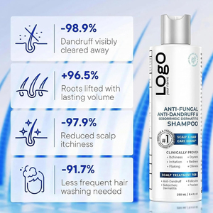 Champú Antifúngico Equilibrado de Marca Privada para el <span class=keywords><strong>Tratamiento</strong></span> del Cuero Cabelludo y el Cabello, para la Caspa y la Picazón, con Ácido Salicílico - Product Image 4