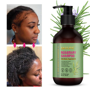 <span class=keywords><strong>Shampooing</strong></span> populaire bio à base de plantes au romarin pour la croissance des <span class=keywords><strong>cheveux</strong></span> <span class=keywords><strong>Shampooing</strong></span> pour <span class=keywords><strong>cheveux</strong></span> secs et abîmés avec logo personnalisé - Product Image 2