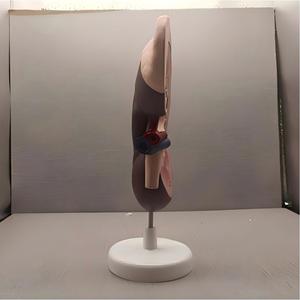 Modelo Anatómico de Riñón con Glándula Adrenal - Herramienta de Enseñanza de Nefrología Desmontable - Product Image 4