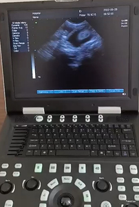 Cardiale Echografie Scannermachines Voor Ultrasone Apparatuur Voor Dierenbenodigdheden - Product Image 6