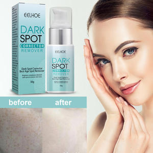 ครีมลบรอยแ<span class=keywords><strong>ผล</strong></span>เป็นจากสิว,ครีมทาผิวหน้าสำหรับรักษาสิวจุดด่างดำครีมทาผิวขาวแตกลาย - Product Image 2