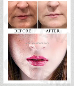 Công thức tùy chỉnh nhau thai viên nang Mặt huyết thanh cho tất cả các loại da - Product Image 5