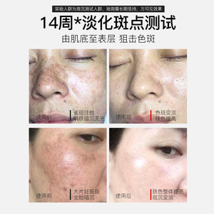 Beilingmei Whitening And Freckle <b>Removing</b> Serum 120ml With Even Skin Tone - Product Image 3