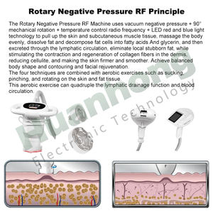 Massaggiatore Portatile 2 in 1 con Rullo a Vuoto e Sfera Interna Verticale 4 in 1 - Product Image 2