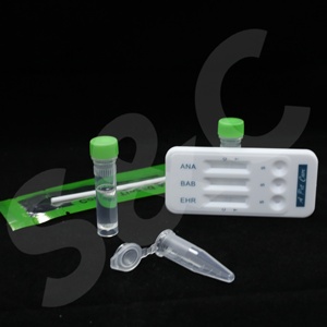 Veteriner hızlı tanı testleri EHR Ab+ <span class=keywords><strong>ANA</strong></span> Ab+ BAB Ab üçlü kitleri 5-10 dakika sonuç verir - Product Image 2