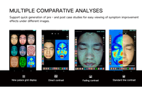Analyseur de peau à 5 spectres haute résolution pour salon de beauté et centre esthétique