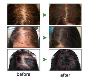 Aceite para el Crecimiento del Cabello <span class=keywords><strong>de</strong></span> Romero y Ricino 100% Natural <span class=keywords><strong>de</strong></span> Marca Privada al por Mayor, Suero Anticaída y Fortalecedor para el Cuidado del Cuero Cabelludo - Product Image 5