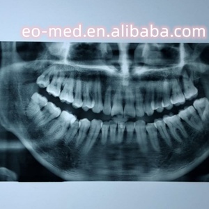 Impresora de Película de Inyección de Tinta de Alta Velocidad para Documentos e Imágenes, Compatible con Formatos de hasta 14 * 17 Pulgadas, Impresora de Rayos X XP02 - Product Image 6