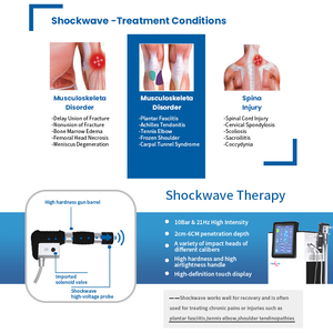 เครื่องอัลตราซาวนด์มือถือระดับ<span class=keywords><strong>มือ</strong></span>อาชีพ อุปกรณ์กายภาพบำบัดด้วยคลื่นกระแทกภายนอกร่างกาย สำหรับโรคข้ออักเสบและอาการ<span class=keywords><strong>ปวด</strong></span><span class=keywords><strong>ข้อ</strong></span> - Product Image 2