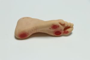 Model Perawatan Kaki Diabetes Tingkat Lanjut untuk Pelatihan dan Penggunaan Medis - Product Image 6