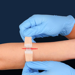 สายรัดปิดแผลที่มีประสิทธิภาพอุปกรณ์แถบผ้าซิปผูกผีเสื้อช่วยการตัด - Product Image 4