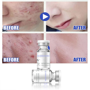 Siero Viso Rassodante al Collagene di Rame Organico e Peptide GHK-Cu con <span class=keywords><strong>Acido</strong></span> <span class=keywords><strong>Ialuronico</strong></span> per Idratazione e Tonificazione della Pelle - Product Image 6