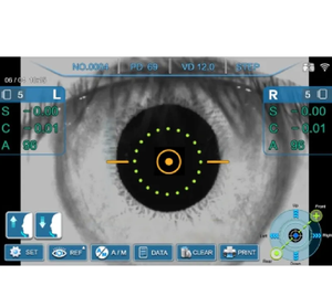 K/<span class=keywords><strong>R</strong></span> REF/<span class=keywords><strong>KEF</strong></span>-Modus Automatisches Autore frakto meter Keratome ter Ark-4000 zu verkaufen - Product Image 6