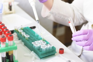 2x Taq Plus <span class=keywords><strong>MasterMix</strong></span> con Dye (JSR-E-213) Premezcla de PCR Lista para Usar para Electroforesis en Gel Directa - Product Image 3