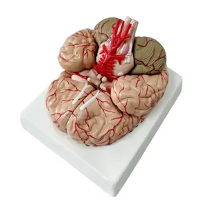 Modelo de anatomía cerebral, arterias cerebrales y función Modelo de anatomía cerebral