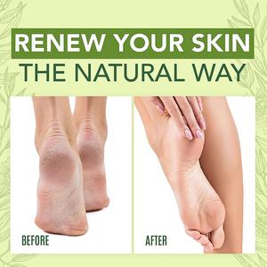 Crema para el Cuidado de los Pies al por Mayor de 50 ml con Aceite de Árbol de Té para Piel Seca, Agrietada, Áspera y Gruesa, Enriquecida con Aloe Vera - Product Image 6