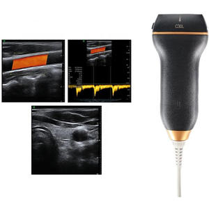 Échographe <span class=keywords><strong>Doppler</strong></span> Couleur Portable Professionnel USB Linéaire pour la Thyroïde, les Articulations, les Voies Sanguines, Compatible Tablette Android et Windows - Product Image 1