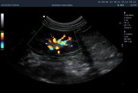 Système de diagnostic médical à ultrasons de qualité supérieure, appareil d'échographie vétérinaire Doppler couleur 4D avec interface à trois sondes