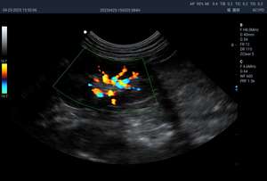 Système de diagnostic médical à ultrasons de qualité supérieure, appareil d'échographie vétérinaire Doppler couleur 4D avec interface à trois sondes - Product Image 4
