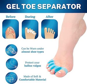 Correcteur d'oignon sans chirurgie pour femmes, lisseur de gros orteils, attelle d'oignon de nuit pour hommes, correction orthopédique - Product Image 5