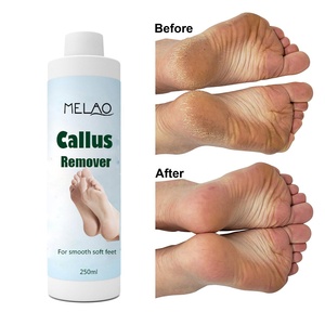 MELAO Gel Professionale Extra Forte per Rimozione <span class=keywords><strong>Calli</strong></span> con Olio di Tea Tree, Esfoliante per <span class=keywords><strong>Piedi</strong></span> e Talloni Screpolati - Product Image 5