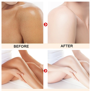 Sıcak Satış Premium Kolajen Kapsülleri Biotin Keratin Hyaluronik Asit Kolajen Cilt Esnekliği ve Beyazlatıcı Takviyesi Kadınlar İçin - Product Image 3