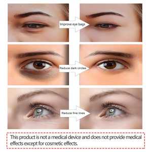 3D <span class=keywords><strong>Eye</strong></span> <span class=keywords><strong>Massager</strong></span> Advanced Beauty Device para círculos escuros Puffiness e rugas Redução Eyecare Óculos para relaxamento - Product Image 3