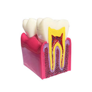 Modelo de Implante Dental de Silicona, Restauración de Patología Nerviosa Removible para Comunicación Completa entre Médico y Paciente - Product Image 3