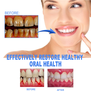 EELHOE gel de blanchiment des dents stylo élimination du tartre des dents jaunes halitose gingivale soulagement de l'inflammation gel professionnel - Product Image 5