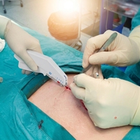 Agrafeuses cutanées jetables 35W à usage unique pour la fermeture des plaies cutanées, présentables
