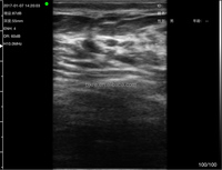 Sonde micro-convexe à ultrasons sans fil vétérinaire Plam + scanner à ultrasons linéaire pour instruments obstétricaux pour animaux