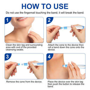 ELAIMEI Portable Large Size <strong>Skin</strong> <strong>Tag</strong> <strong>Removal</strong> Pen Kit Safe and Effective Auto <strong>Skin</strong> <strong>Tag</strong> Remover for Home Use - Product Image 6