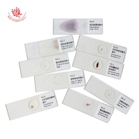 Prepared Slides 10 Kinds Parasite Slides Set Parasitology Microscope Prepared Slides Medical Education