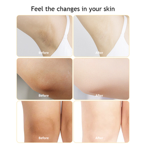Crème éclaircissante pour les taches sombres, peau sans imperfections, aisselles, maillot de bain, intérieur des cuisses, marque privée - Product Image 4