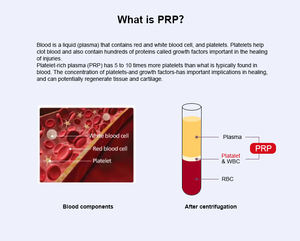 12ml 프리미엄 미니 PRP 키트 얼굴 치료를 위한 젊음의 광채를 깨우다 - Product Image 3