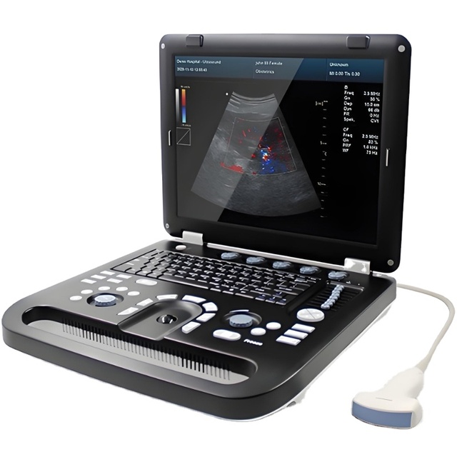 Affordable Portable Ultrasound System with Color Doppler for Diagnostics
