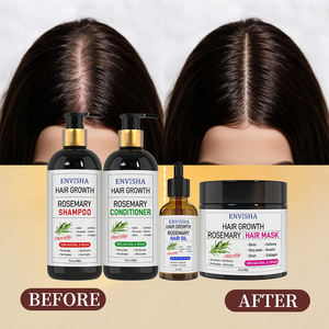 <span class=keywords><strong>Champú</strong></span> y Acondicionador para el Cuidado del Cabello con Romero, para Cabello Largo y Rizado, que Estimula el Crecimiento y Previene la Caída, Suave y Sedoso, Venta al Por Mayor - Product Image 2