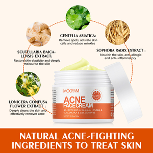 Crema para el Acné <span class=keywords><strong>de</strong></span> Marca Privada del Fabricante, Eficaz y <span class=keywords><strong>de</strong></span> Acción Rápida, con Propiedades Blanqueadoras, Ácido Hialurónico y <span class=keywords><strong>Aloe</strong></span> <span class=keywords><strong>Vera</strong></span> - Product Image 6