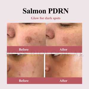 Private Label Lachs PDRN Glow Serum Ampulle Intensive Feuchtigkeit Haut Plump ing Verbessert die Haut ausstrahlung Poren pflege - Product Image 4