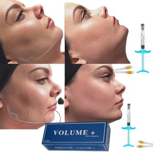 SEEGLOW Ha Gel Iniettabile Reticolato Anti-Età e Sbiancante per Viso, Linea Mascellare, Guance, Mento, Naso, Occhi, Labbra - Filler Dermico all'<span class=keywords><strong>Acido</strong></span> <span class=keywords><strong>Ialuronico</strong></span> - Product Image 3