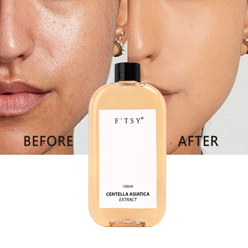 OEM Tranexamic Acid Toner Brightening Hydrating
