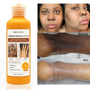 Producto para el Cuidado de la Piel Corporal de Marca Privada, Exfoliante para Eliminar Piel Muerta, Blanqueador de Piel, Loción Exfoliante de Naranja Eficaz - Product Image 1