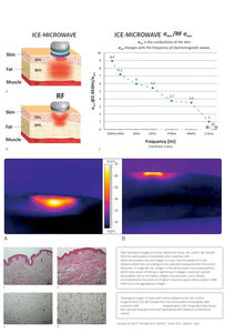Machine de raffermissement de la peau et d'élimination de la cellulite Coolwave 2026 populaire pour salon - Product Image 4