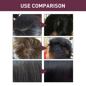 South <span class=keywords><strong>Moon</strong></span> corée polygone assombrissant shampooing cheveux gris lavage assombrissant anti perte démangeaisons soulageant le savon noir pour les cheveux gris - Product Image 3