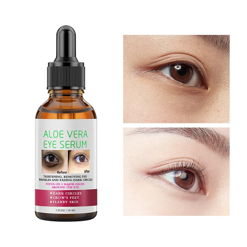 Private Label Natural Aloe Vera Gel Eye Serum Moisturizing And Hydrating Dark Removal Circles Reduces Fine Lines Eye Serum
