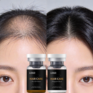 เซรั่มบำรุงหนังศีรษะ โพลีเปปไทด์ โกรว์ แฟคเตอร์ ช่วยเร่งการงอกของเส้นผม <span class=keywords><strong>ผง</strong></span>ไลโอฟิไลซ์ ผสมสเต็มเซลล์ EGF บำรุงราก<span class=keywords><strong>ผม</strong></span>ให้แข็งแรง - Product Image 6